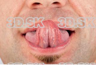 Tongue texture of Dale 0002